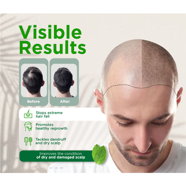 Extra Strong Rosemary and Ginger Dropper